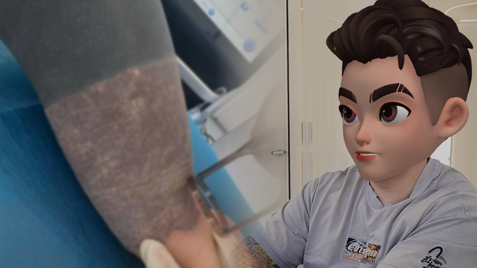 超高浓度黑臂纹身清洗感受